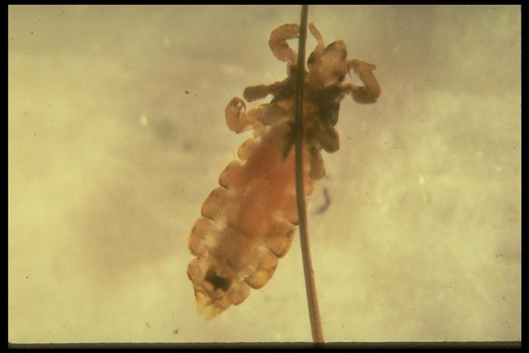 Head louse, Pediculus humanus capitus DeGeer (Phthiraptera: Pediculidae). Photo by B. Brewer.