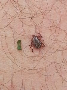 American dog tick